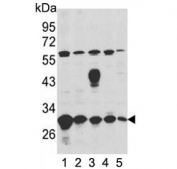 Western blot testing of human 1) A2058, 2) A375, 3) MCF7, 4) NCI-H460 and 5) Y79 cell lysate with Endoplasmic reticulum resident protein 29 antibody. Predicted molecular weight: ~29 kDa.