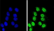 Immunofluorescent staining of human HeLa cells with BAG-1 antibody (green) and DAPI nuclear stain (blue).