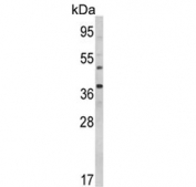 Western blot testing of human MBA-MB-231 cell lysate with BAG-1 antibody.  Predicted molecular weight ~50 kDa (long form), 29-33 (short form).