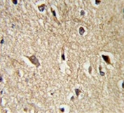 IHC testing of FFPE human brain tissue with BAG-1 antibody. HIER: steam section in pH6 citrate buffer for 20 min and allow to cool prior to staining.