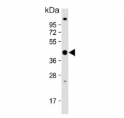 Western blot testing of human Jurkat cell lysate with PSMD13 antibody. Predicted molecular weight ~43 kDa.