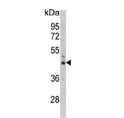 Western blot testing of human Y79 cell lysate with PSMD13 antibody. Predicted molecular weight ~43 kDa.