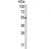 Western blot testing of human A2058 cell lysate with Protein disulfide-isomerase A3 antibody. Predicted molecular weight ~57 kDa.