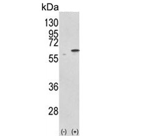 Western blot testing of 1) non-transfected and 2) transfected 293 cell lysate with Protein disulfide-isomerase A3 antibody.