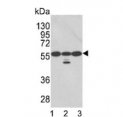 Western blot testing of human 1) A2058, 2) A375 and 3) Ramos cell lysate with PDIA3 antibody. Predicted molecular weight ~57 kDa.
