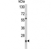 Western blot testing of human CCRF-CEM cell lysate with Peroxiredoxin 1 antibody. Predicted molecular weight ~22 kDa.