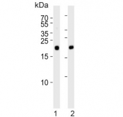 Western blot testing of 1) mouse heart and 2) rat heart tissue lysate with PRDX2 antibody. Predicted molecular weight ~22 kDa.