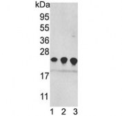 Western blot testing of 1) human MDA-MB-231, 2) HEK293 and 3) mouse brain lysate with PRDX2 antibody. Predicted molecular weight ~22 kDa.