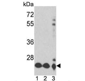 Western blot testing of human 1) NCI-H460, 2) MDA-MB-231 and 3) HepG2 cell lysate with PRDX3 antibody. Predicted molecular weight ~28 kDa.