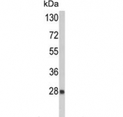 Western blot testing of human CCRF-CEM cell lysate with PRDX6 antibody. Predicted molecular weight ~25 kDa.