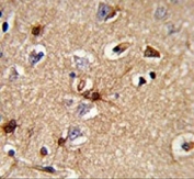IHC testing of FFPE human brain tissue with PRDX6 antibody. HIER: steam section in pH6 citrate buffer for 20 min and allow to cool prior to staining.