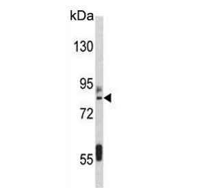 Western blot testing of human HeLa cell lysate with IMMT antibody. Predicted molecular weight ~84 kDa.