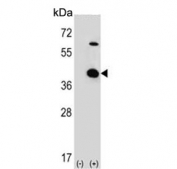 Western blot testing of 1) non-transfected and 2) transfected 293 cell lysate with UNRIP antibody. 