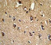 IHC testing of FFPE human brain tissue with PPIA antibody. HIER: steam section in pH6 citrate buffer for 20 min and allow to cool prior to staining.