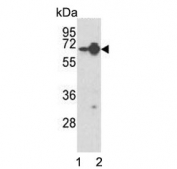 Western blot testing of human 1) HepG2 and 2) Jurkat cell lysate with HNRPL antibody. Predicted molecular weight ~64 kDa.