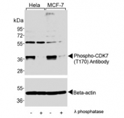 Western blot testing of lysate from human HeLa and MCF7 cells treated or non-treated with lambda protein phosphatase with phospho-CDK7 antibody. Expected molecular weight ~39 kDa.