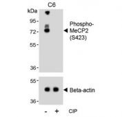 Western blot testing of lysate from rat C6 cells treated or non-treated with CIP/CIAP (calf intestinal alkaline phosphatase) with phospho-MeCP2 antibody. Commonly observed molecular weights: ~55 kDa and ~75 kDa.