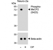Western blot testing of lysate from mouse Neuro-2a cells treated or non-treated with CIP/CIAP (calf intestinal alkaline phosphatase) with phospho-MeCP2 antibody. Commonly observed molecular weights: ~55 kDa and ~75 kDa.