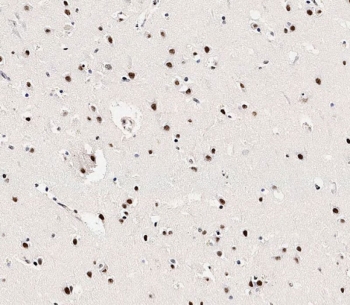 IHC testing of FFPE human brain tissue with phospho-MeCP2 antibody. HIER: steam section in pH9 EDTA for 20 min and allow to cool prior to staining.