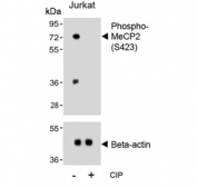 Western blot testing of lysate from human Jurkat cells treated or non-treated with CIP/CIAP (calf intestinal alkaline phosphatase) with phospho-MeCP2 antibody. Commonly observed molecular weights: ~55 kDa and ~75 kDa.