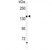 Western blot testing of human HepG2 cell lysate with PFAS antibody. Predicted molecular weight ~145 kDa.