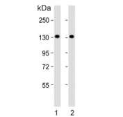 Western blot testing of human 1) 293T and 2) Jurkat cell lysate with PFAS antibody. Predicted molecular weight ~145 kDa.