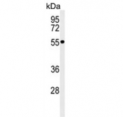 Western blot testing of human MCF7 cell lysate with PRP19 antibody. Predicted molecular weight ~55 kDa.