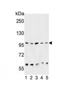 Western blot testing of 1) human HepG2, 2) mouse liver, 3) hamster CHO, 4) human K562 and 5) human HeLa cell lysate with HSP90B1 antibody. Predicted molecular weight ~94 kDa.