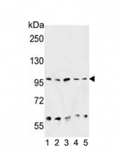 Western blot testing of 1) human HepG2, 2) mouse liver, 3) hamster CHO, 4) human K562 and 5) human HeLa cell lysate with HSP90B1 antibody. Predicted molecular weight ~94 kDa.