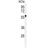 Western blot testing of human HL-60 cell lysate with FUT6 antibody. Predicted molecular weight ~42 kDa, but may be observed at higher molecular weights due to glycosylation.