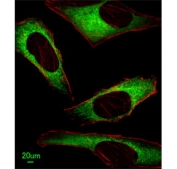 Immunofluorescent staining of human HeLa cells with Inosine triphosphate pyrophosphatase antibody (green) and anti-Actin (red).