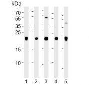 Western blot testing of human 1) A375, 2) HeLa, 3) HepG2, 4) mouse brain and 5) rat liver lysate with Inosine triphosphate pyrophosphatase antibody. Predicted molecular weight ~21 kDa.