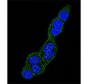 Immunofluorescent staining of human HeLa cells with Cytokeratin 18 antibody (green) and DAPI nuclear stain (blue).