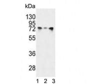 Western blot testing of human 1) HeLa, 2) A2058 and 3) NCI-H460 cell lysate with HSPA5 antibody. Predicted molecular weight: ~73 kDa, but routinely observed at 70-78 kDa.