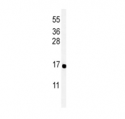 Western blot testing of human MCF7 cell lysate with Peptide YY antibody. Expected molecular weight: 11/4 kDa (preproprotein/mature).