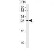 Western blot testing of human SH-SY5Y cell lysate with ZDHHC21 antibody. Predicted molecular weight ~31 kDa.