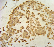 IHC testing of FFPE human testis tissue with ZDHHC21 antibody. HIER: steam section in pH6 citrate buffer for 20 min and allow to cool prior to staining.