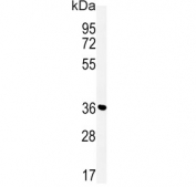 Western blot testing of human Jurkat cell lysate with Mitoferrin-2 antibody. Predicted molecular weight ~39 kDa.