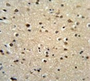 IHC testing of FFPE human brain tissue with Teashirt homolog 2 antibody. HIER: steam section in pH6 citrate buffer for 20 min and allow to cool prior to staining.