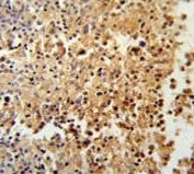 IHC testing of FFPE human spleen tissue with AMSH-like protease antibody. HIER: steam section in pH6 citrate buffer for 20 min and allow to cool prior to staining.