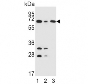 Western blot testing of human 1) K562, 2) HepG2 and 3) Jurkat cell lysate with Pyruvate Dehydrogenase E2 antibody. Predicted molecular weight ~69 kDa.