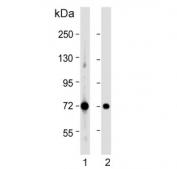 Western blot testing of human 1) LNCaP and 2) MCF7 cell lysate with Pyruvate Dehydrogenase E2 antibody. Predicted molecular weight ~69 kDa.