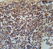 IHC testing of FFPE human lymph node tissue with CYRIA antibody. HIER: steam section in pH6 citrate buffer for 20 min and allow to cool prior to staining.
