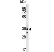 Western blot testing of human NCI-H460 cell lysate with CYRIA antibody. Predicted molecular weight ~37 kDa.