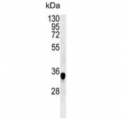 Western blot testing of mouse spleen tissue lysate with CYRIA antibody. Predicted molecular weight ~37 kDa.