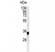 Western blot testing of mouse spleen tissue lysate with CYRIA antibody. Predicted molecular weight ~37 kDa.