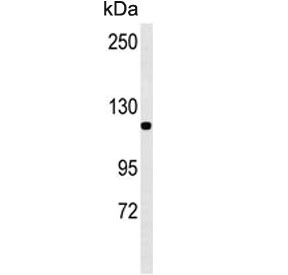 Western blot testing of human NCI-H460 cell lysate with IPO7 antibody. Predicted molecular weight ~120 kDa.