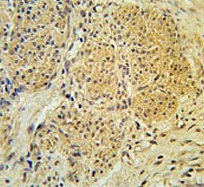 IHC testing of FFPE human cervix tissue with IPO7 antibody. HIER: steam section in pH6 citrate buffer for 20 min and allow to cool prior to staining.