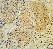IHC testing of FFPE human cervix tissue with IPO7 antibody. HIER: steam section in pH6 citrate buffer for 20 min and allow to cool prior to staining.