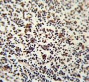 IHC testing of FFPE human lymph node tissue with Lymphocyte Specific Protein 1 antibody. HIER: steam section in pH6 citrate buffer for 20 min and allow to cool prior to staining.
